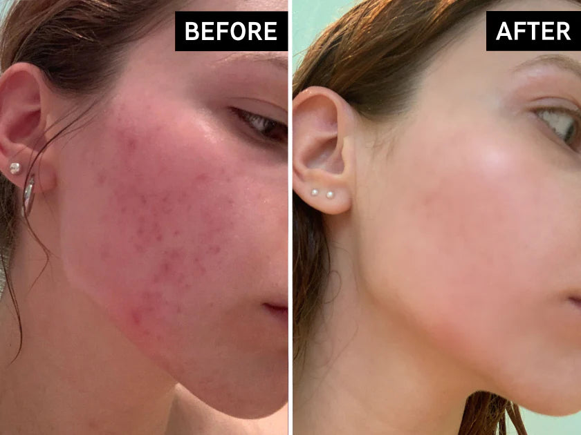Hydration Serum